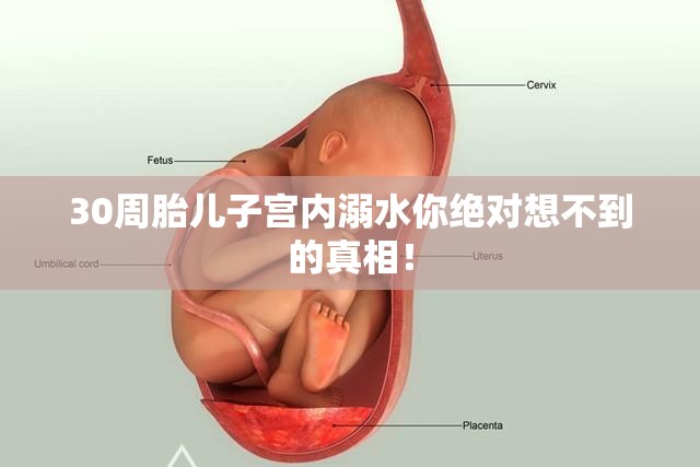 30周胎儿子宫内溺水