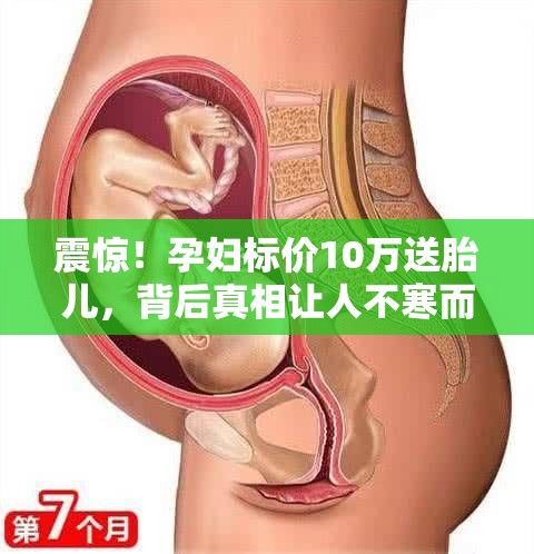 孕妇标价10万送胎儿